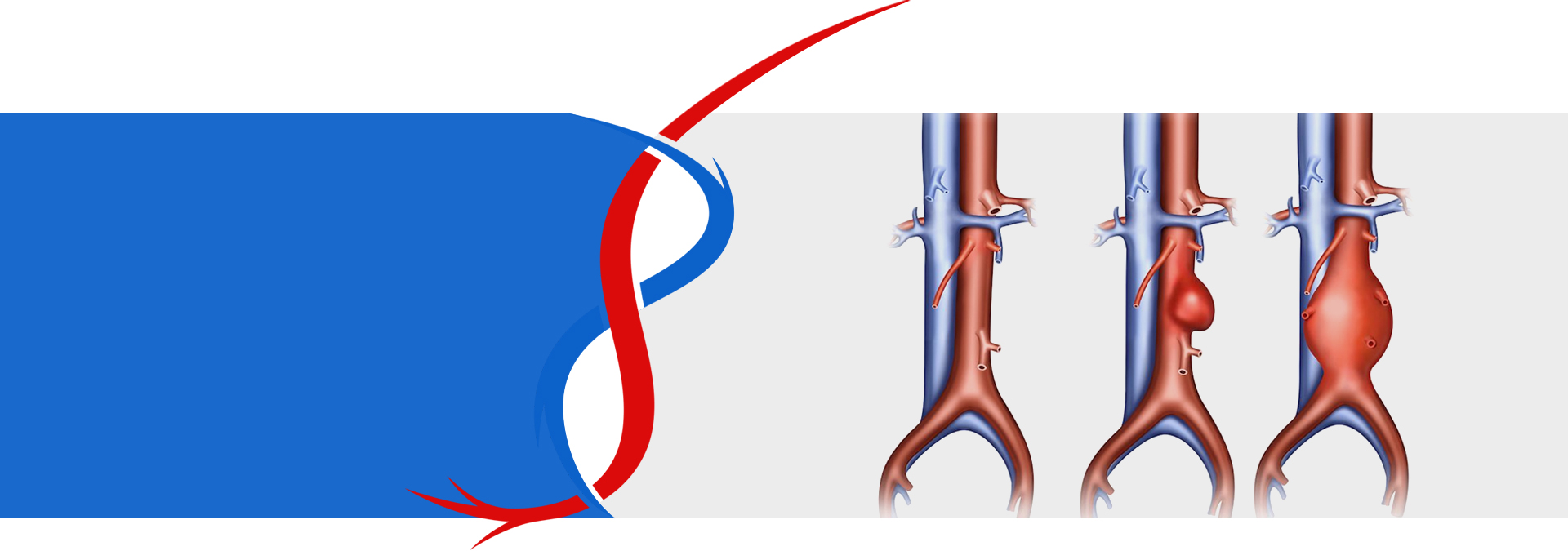 Vascular Risk Assessment